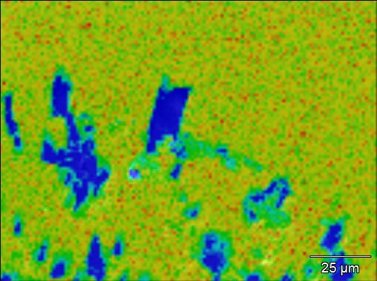 2.2.2. Elementverteilung