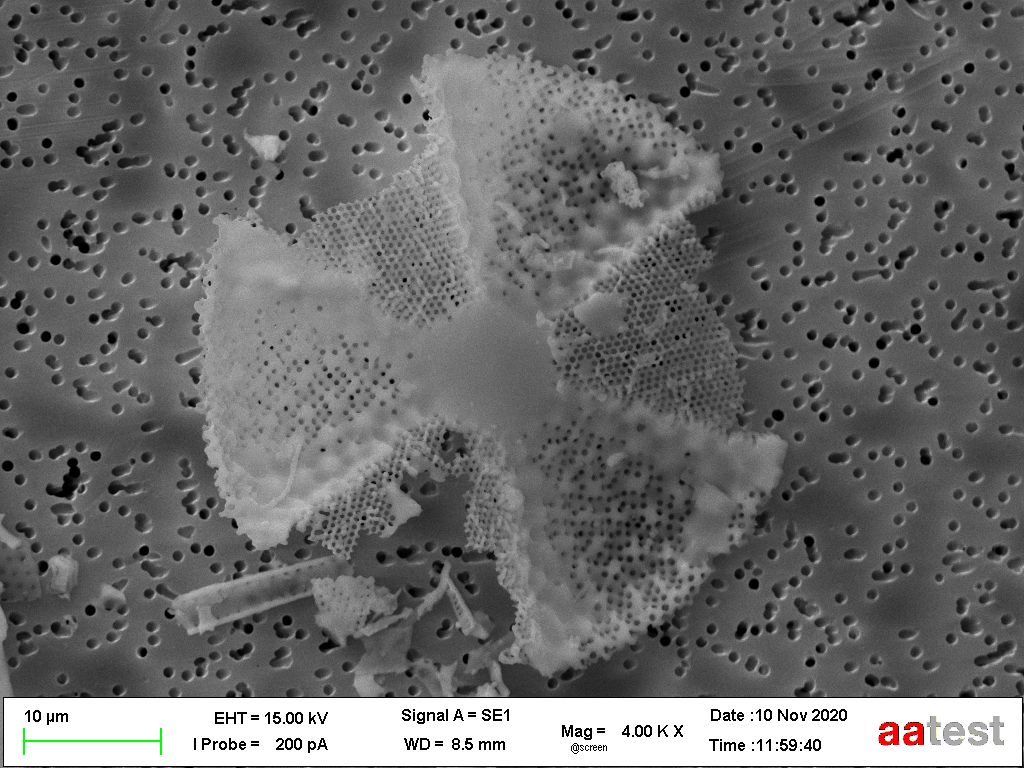 Kieselalgen Skelet A